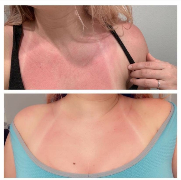 PRE-ORDER ONLY Stretch Mark & Multi-Tasking Cream - Picture 3 of 8